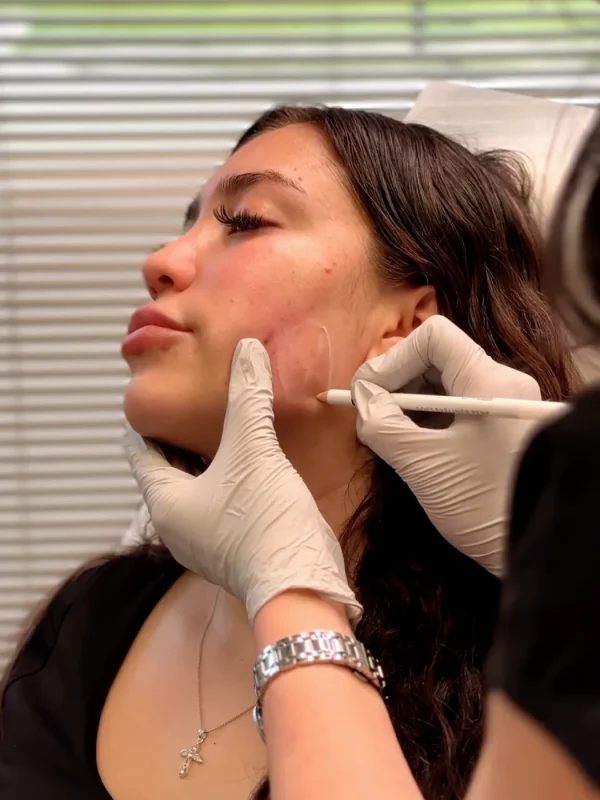 Masseter & Facial Slimming
